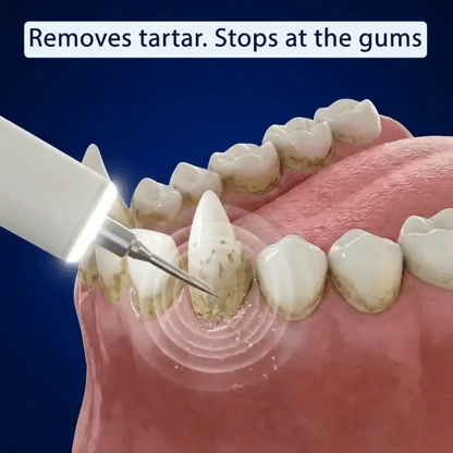 ZakkaHub ultrasonic dog tartar remover product image 2